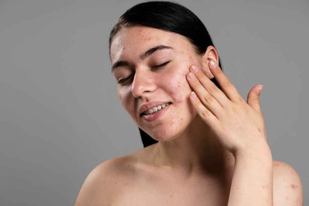Over-Exfoliating